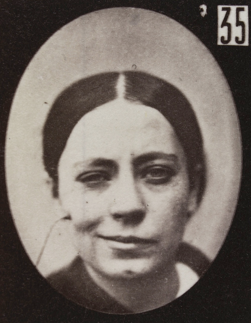 Illustration for article titled Terrifying, Century-Old Photographs from Neuroscience Experiments